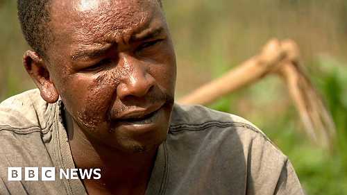 'Where I'm from nobody has ever seen this disease'